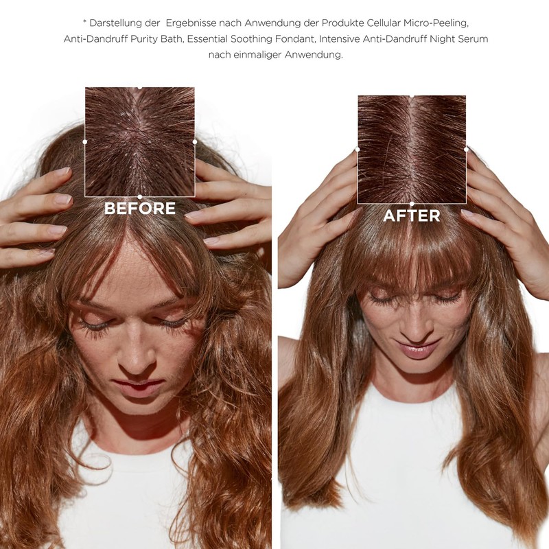 Kérastase Symbiosis, Exfoliating Anti-Dandruff Hair Care, Exfoliating for Sensitive and