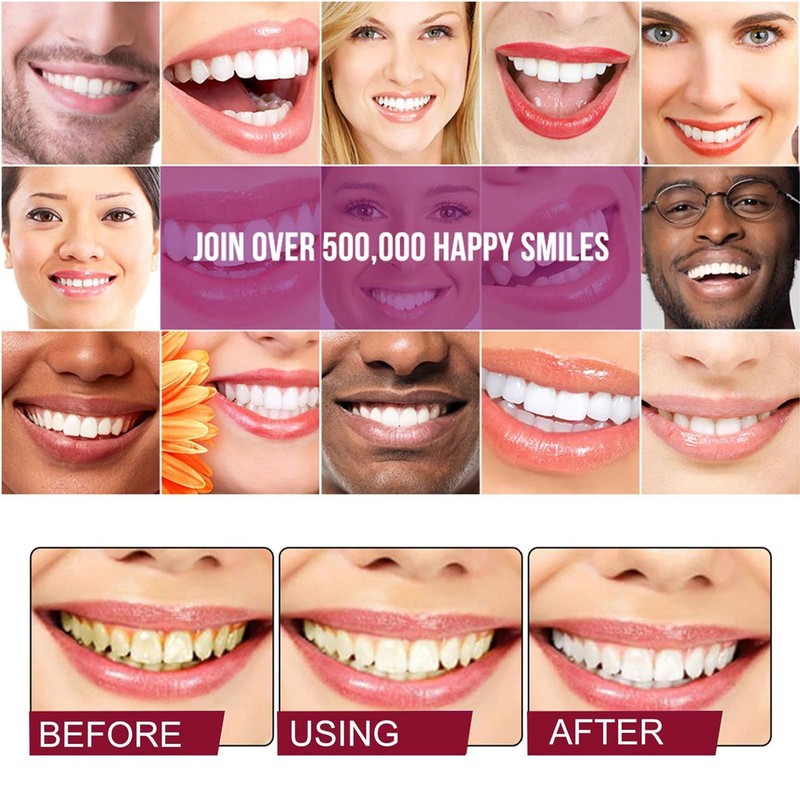 Sp-8 Probiotics Whitening Toothpaste, Sp-8 Probiotic Toothpaste, Sp 8 Probiotic