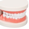 Dental Disease Caries Teeth Model Resin Simulation Teaching Prop Dental