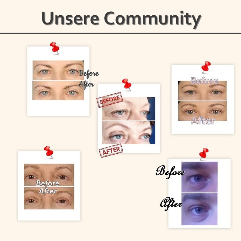 VENICCE LOVE Invisible Lid Stripes, Eyelid Stripes, Eyelid Tape, Eye
