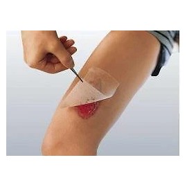 SMITH & NEPHEW INC Cuticerin  Low-Adherent Gauze Dressing 3" x 8" BX of 10