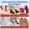 Bsmkd 64pz Gel Fortalecedor Para Uñas For El Tratamiento