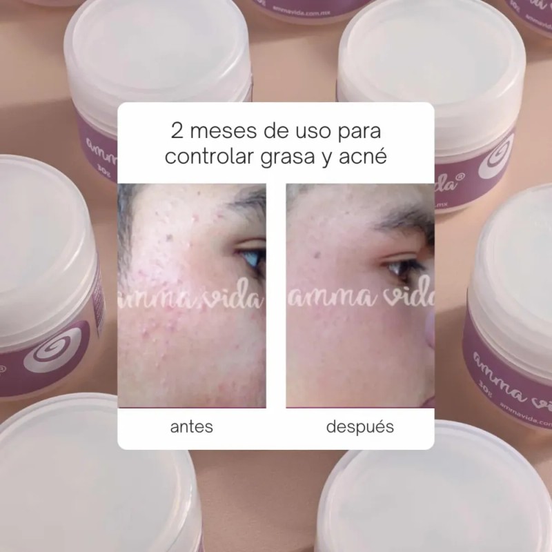 Crema Extra Nutrición Amma Vida, Nutre Tu Piel Y Humecta