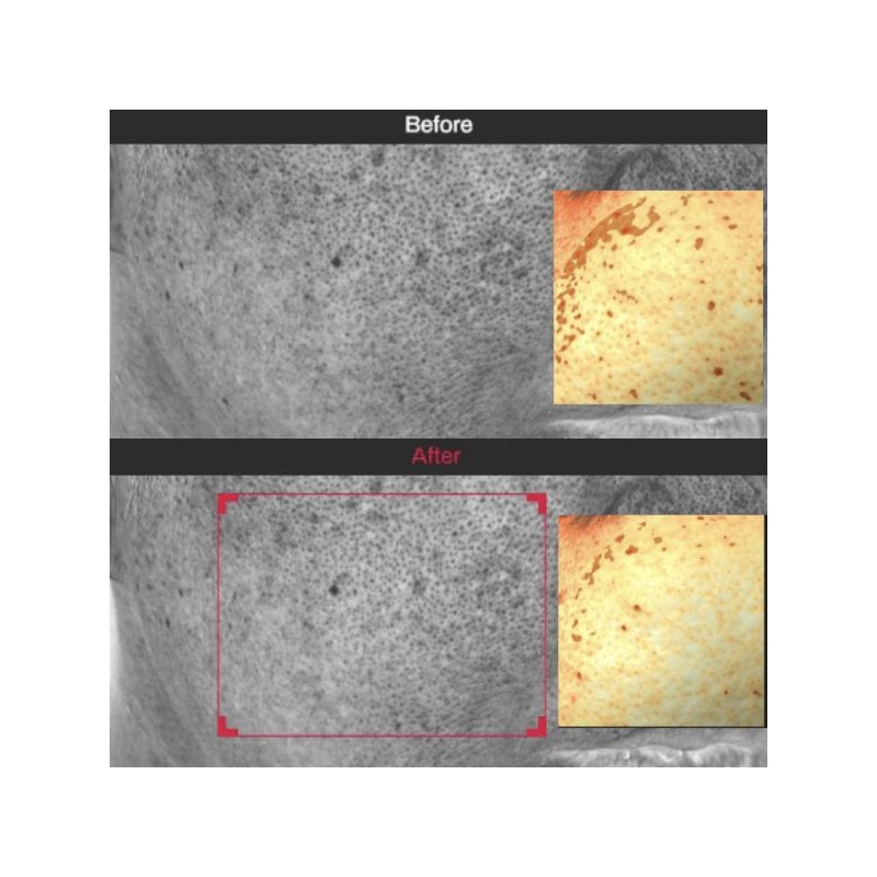 MEDITHERAPY Tranexamic Acid Skin Booster Cream 100ml with Boost Cap