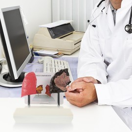 PartyKindom Smoking and Normal Lung Comparison Model, Medical Teaching Tool for Students Educators, Accurate Anatomy Display Model Demonstrating Lung Health Pathological Features