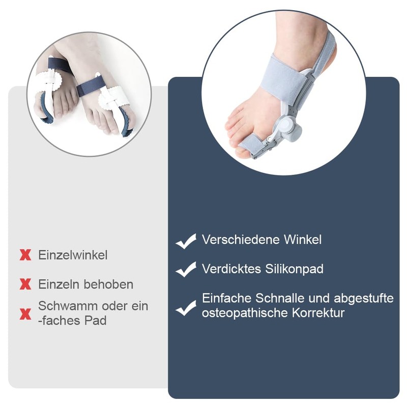 RDTOK Hallux Valgus Correction (Left Foot)