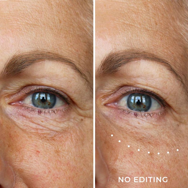 WUNDER2 Wunderlift Instant Eye Tightening Serum, Temporary Firming & Lifting