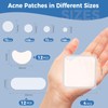 (7 Sizes 448 Counts) Large Pimple Patches for Face, Chin