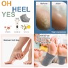 Meyluth Electric Foot Scrubber File Callus Remover with Socks, Electric