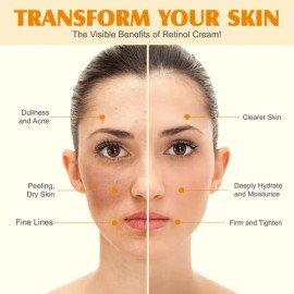 Crema Hidratante Piel Reseca Sebo Res Miel Natural