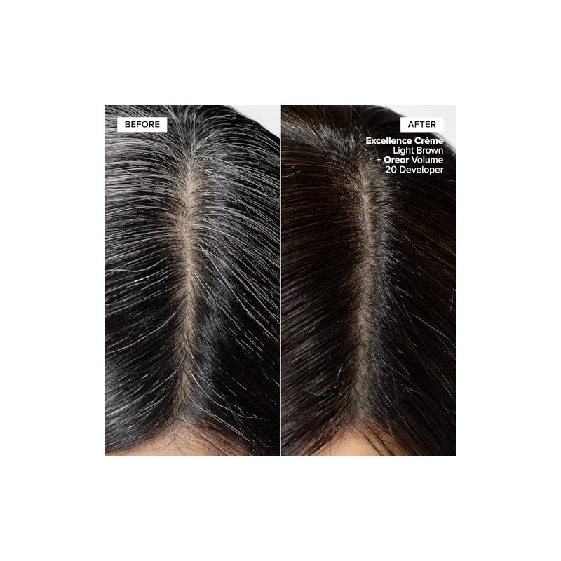 L'oreal Excellence Creme Permanent Hair Color, Medium Ash Brown No.5.1,