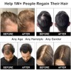 Gorro láser para el crecimiento del cabello, gorro de terapia