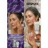 Exderm White Crema Despigmentante Intensiva Noche 30ML Todo Tipo de
