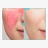 TOSOWOONG SOS Repair CICA Clinic Zinc Cream, 100,000ppm Zinc Oxide,