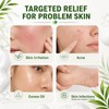 Tea Tree Soap with Green Tea & Tea Tree Oil,