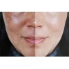 Serum Crema C Elimina Manchas Paño Pecas Aclarante Anti Edad