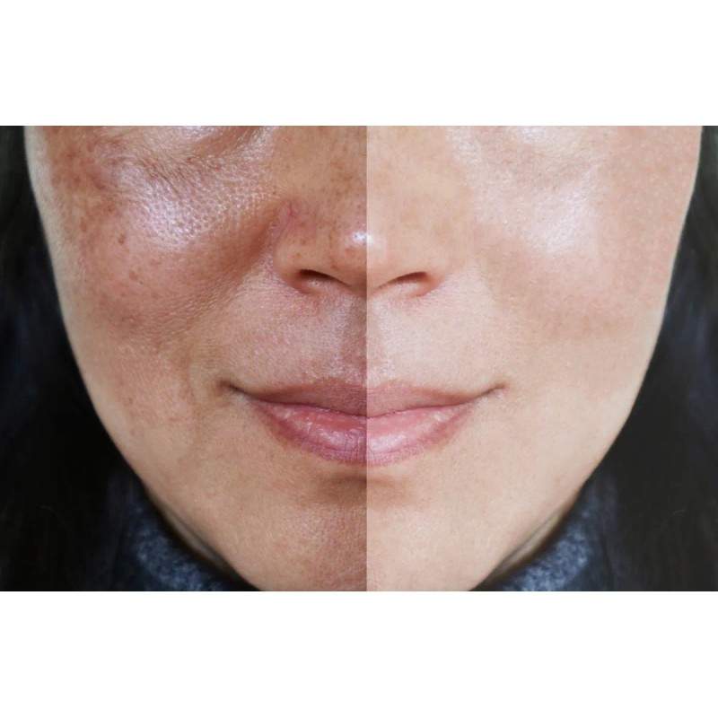 Serum Crema C Elimina Manchas Paño Pecas Aclarante Anti Edad