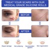 Self-adhesive Silicone Scar Patch 1.6x120 inches Transparent Invisible Scar Sheets
