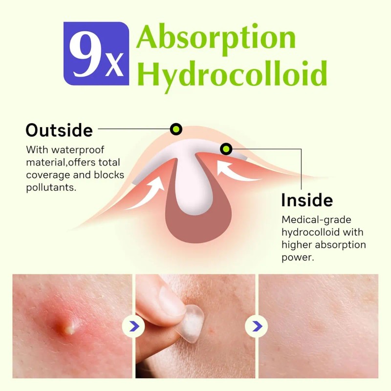 Parches De Espinillas Para Cara, Parches Invisibles Para El