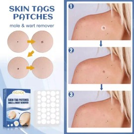 3×eliminador Lunares Y Verrugas Parches Quita Verrugas 1pcs