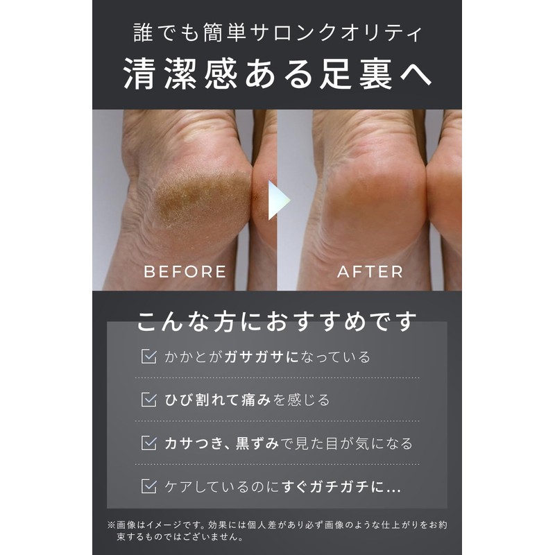 PremiumBLACK Heel Exfoliating Dermatologist Joint Men's Coarse/Fine Double-Sided Heel File
