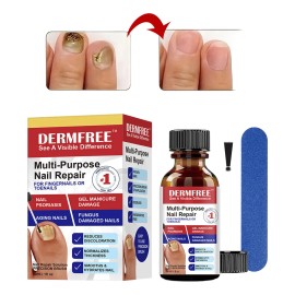 Fungicida Para Uñas Eliminar Hongos En Uñas De Manos Y Pies