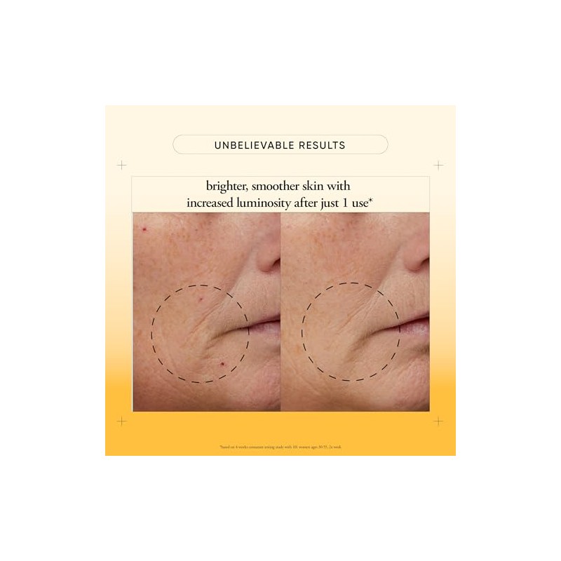 philosophy microdelivery resurfacing peel kit