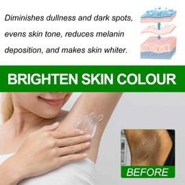 Whitening Face and Body Cream, Whitening Cream, Armpit Whitening Cream, Whitening Cream, for Armpits, Knees, Elbows, Sensitive and Private Areas