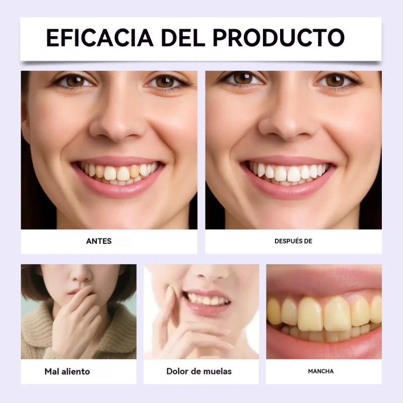 3 Lápiz Blanqueador Dientes Elimina Manchas Limpiador Dental