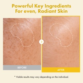 TOSOWOONG Real Kojic Acid Turmeric Fit Peel-Off, 50 ml