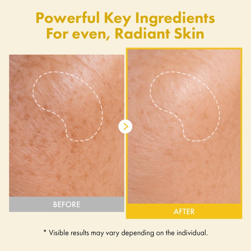 TOSOWOONG Real Kojic Acid Turmeric Fit Peel-Off, 50 ml