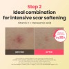 Dr.G [Dr.G]R.E.D Blemish Repair Soothing Cream 50ml