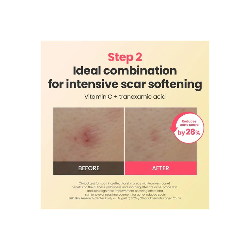 Dr.G [Dr.G]R.E.D Blemish Repair Soothing Cream 50ml