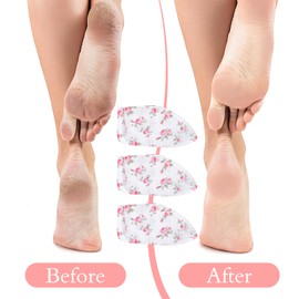 6Pcs Moisturizing Socks Overnight for Dry Cracked Feet, Cotton Sleep Socks Sleep Sock with Floral Print for Women Men, Soft Feet Moisturizer Sock or Softening, Care After Pedicure