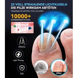 6.0 Upgrade Antimykotischer Laser Nagelpil Lasergerät【30/60/99 Sekunden Smart Cycle】Bereit für den Einsatz zu Hause/unterwegs Selbstbewusste Nägel Haben(Weiß)