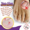 Ingrown Stickers, Corrector Pedicure Tools, Toenail Patch, Ingrown Toenails, Ingrown