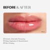 VT COSMETICS Reedle Shot Lip Plumper - Expert, 0.15 oz