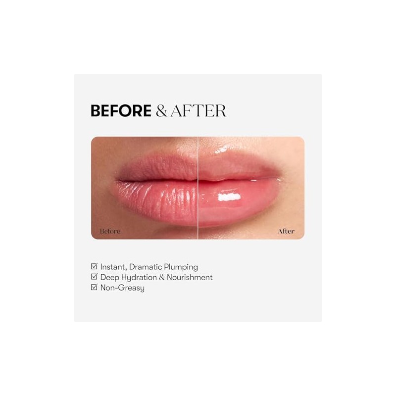 VT COSMETICS Reedle Shot Lip Plumper - Expert, 0.15 oz