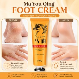 Ma You Qing Moisturizing Foot Cream for Dry Rough Skin, Hand & Foot Care Cream for Cracked Heels, Dry Soles and Rough Hands, Daily Skin Softening Cream for Men and Women