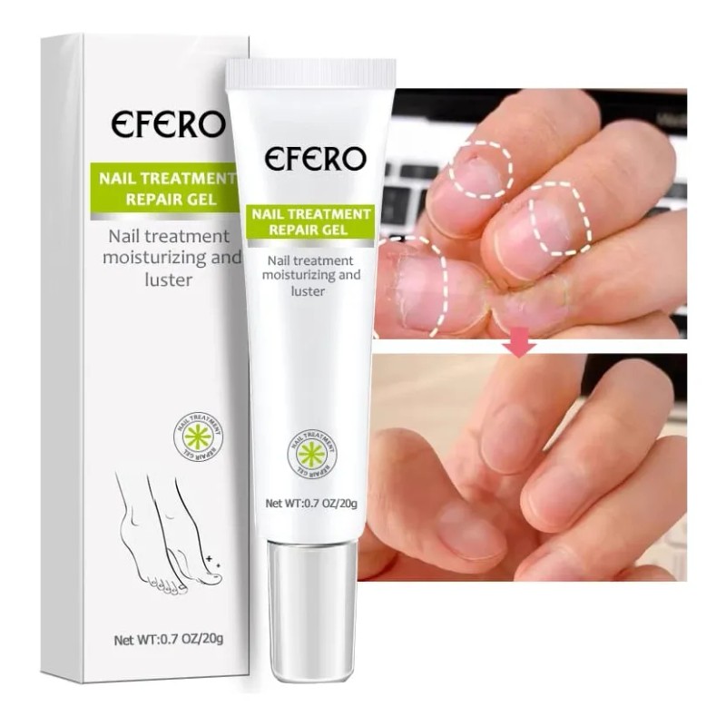 Gel Antihongo Tratamiento Reparador De Uñas Efero 2 Piezas