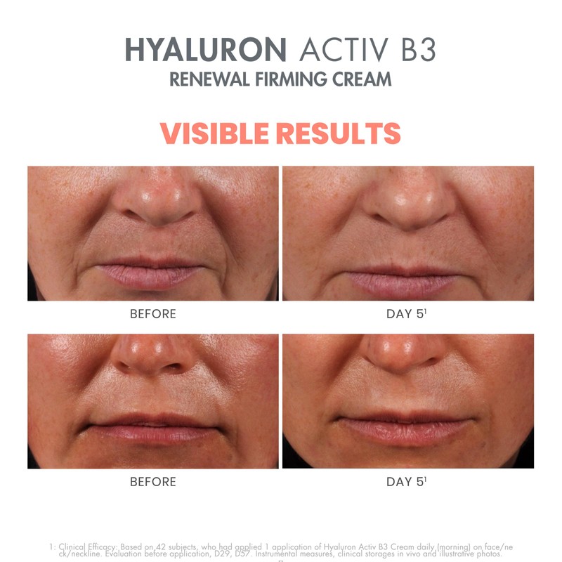AVENE Hyaluronic Activ B3 Cell Renewing Cream 50 ml