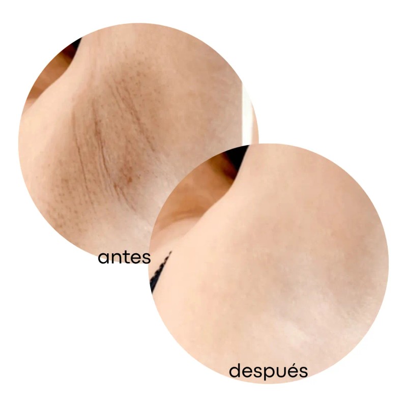 Exfoliante Aclara, Desmancha, Elimina Células Muertas 60 Ml Todo Tipo
