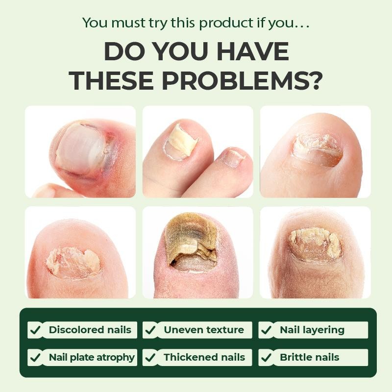 Kreain Multi-Purpose Nail Repair, Nail Solution for Discolored and Damaged