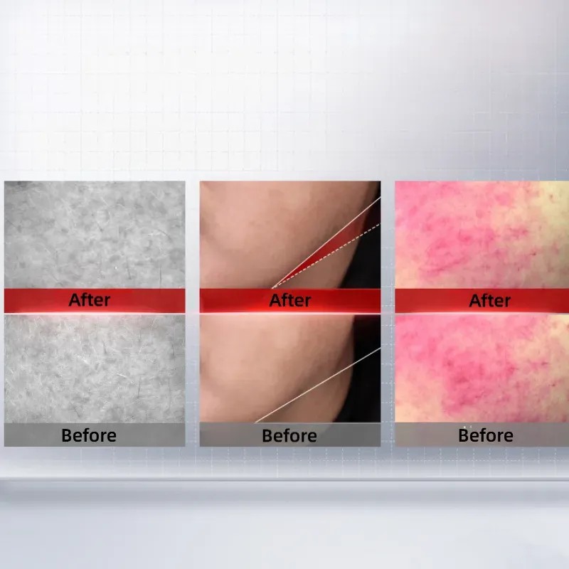 Proya Ruby Ampolla Serum Antiedad Y Reafirmante