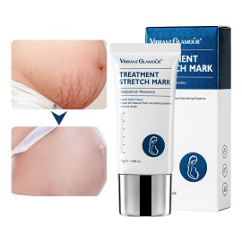 Crema Para Estrías En Embarazo Eliminar Las Líneas De Embara