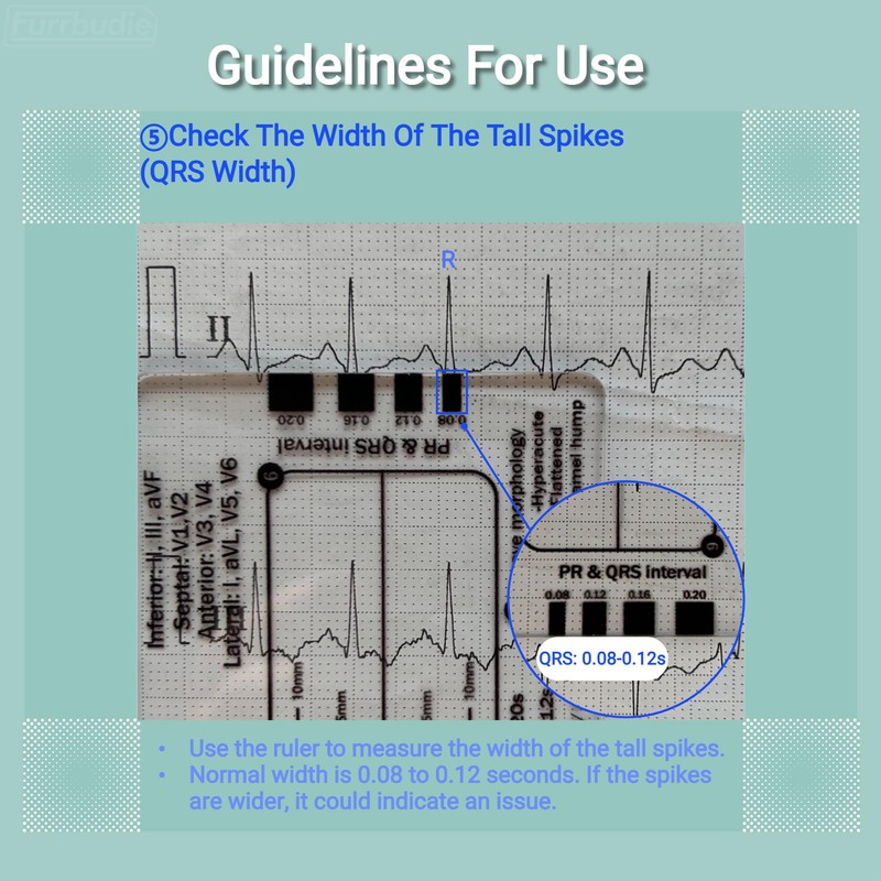 ECG 7 Step Ruler 2pcs ECG Ruler Plastic Ruler Measuring