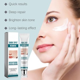 Brightening Freckle Cream for Face - Dark Spot Corrector Treatment with Vitamin C,Fades Age Spots & Hyperpigmentation,Gentle Moisturizing Formula for All Skin Types,Fast Absorbing (1PCS)