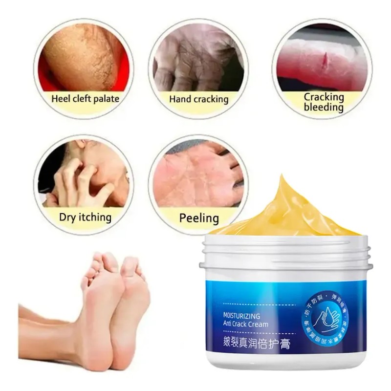 Crema Antisequedad Para Reparar Las Grietas De Los Pies Y