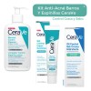 Skincare Anti Acné Espinillas Cerave Control Imperfecciones