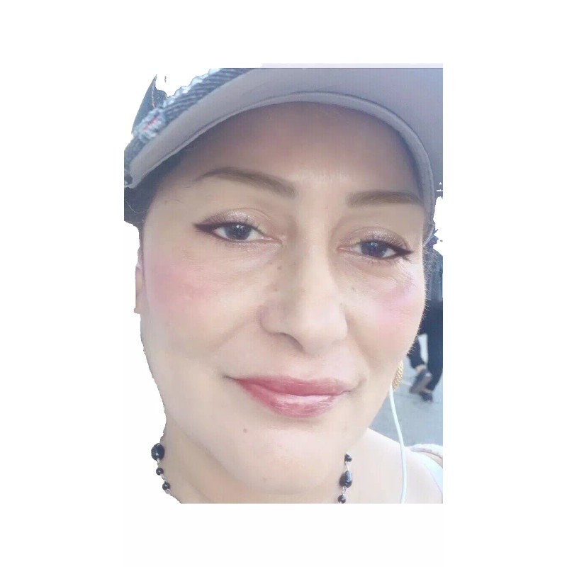 SAMMY DAY CREAM: TE MANTIENE LA PIEL LIBRE DE MANCHAS